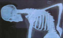 skeleton