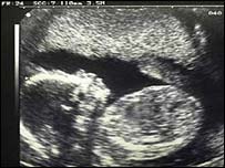 _42825151_ultrasound203.jpg