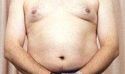 A naked fat man