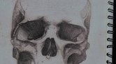 Skull Skull