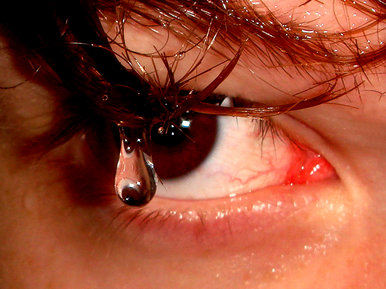 Eye drop