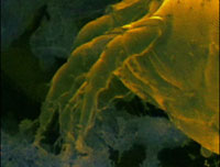 co_dustmites_203x152.jpg