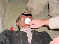 Preso iraquiano torturado em Abu Ghraib, com corte no pescoço/Cortesia TV SBS