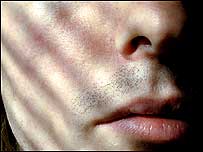 Lips
