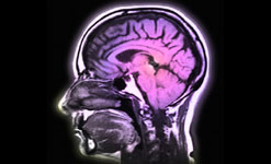 Brain scan