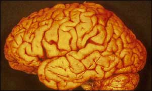 cerebro3.jpg