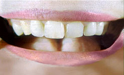 mouth