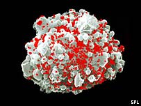 Célula infectada com o vírus HIV